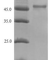 Escherichia coli 30S ribosomal protein S2 (rpsB) Recombinant Protein, N-10His-SUMO/C-Myc - BioCrest Sci