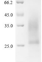 Mouse Collagen triple helix repeat-containing protein 1 (Cthrc1) Recombinant Protein, C-His - BioCrest Sci