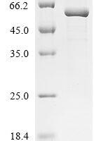Mouse Intestinal-type alkaline phosphatase (Iap) Recombinant Protein - BioCrest Sci