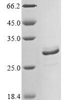 Human Amelogenin, X isoform (AMELX) Recombinant Protein, N-10His/C-Myc - BioCrest Sci