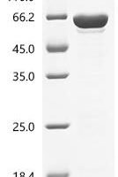 Rickettsia conorii Chaperonin GroEL (groEL), partial, Biotinylated Recombinant Protein - BioCrest Sci