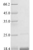 Human SH3 and PX domain-containing protein 2A (SH3PXD2A), partial Recombinant Protein, N-10His/C-Myc - BioCrest Sci