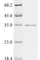 Mouse Hemoglobin subunit alpha (Hba) Recombinant Protein, N-His-SUMO - BioCrest Sci