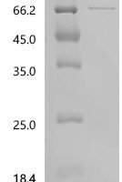 Human Serum paraoxonase/arylesterase 1 (PON1) Recombinant Protein, C-GST - BioCrest Sci
