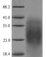 Centruroides suffusus Beta-mammal toxin Css4 Recombinant Protein, N-His - BioCrest Sci
