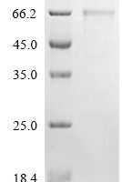 AKV murine leukemia virus Envelope glycoprotein (env), partial Recombinant Protein, C-10His - BioCrest Sci