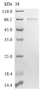 AKV murine leukemia virus Envelope glycoprotein (env), partial Recombinant Protein, C-10His, AKV murine leukemia virus (AKR (endogenous) murine leukemia virus), Baculovirus, C-terminal 10xHis-tagged, 51.7 kDa, purity >≥ 85% as determined by SDS-PAGE.