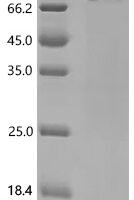 Human NADPH--cytochrome P450 reductase (POR), partial Recombinant Protein, C-His - BioCrest Sci