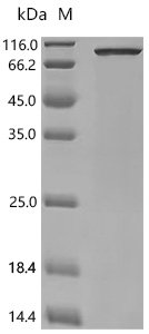 Human NADPH--cytochrome P450 reductase (POR), partial Recombinant Protein, C-His, Homo sapiens (Human), E.coli, C-terminal 6xHis-tagged, 82.8 kDa, purity >≥ 85% as determined by SDS-PAGE.