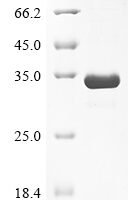 Mouse Olfactomedin-4 (Olfm4), partial Recombinant Protein - BioCrest Sci