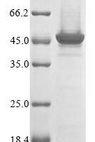 Mouse Trifunctional enzyme subunit alpha, mitochondrial (Hadha), partial Recombinant Protein, N-10His/C-Myc, aa 348–763, Baculovirus - BioCrest Sci