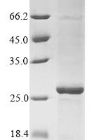 Mesorhizobium delmotii FMN dependent NADH:quinone oxidoreductase (azoR) Recombinant Protein - BioCrest Sci