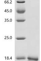 Cat Major allergen I polypeptide chain 2 (CH2) Recombinant Protein, C-His, aa 18–109, E.coli - BioCrest Sci