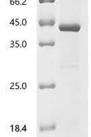 Mouse Galectin-9 (Lgals9) Recombinant Protein - BioCrest Sci