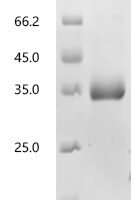 Human Insulin-like growth factor-binding protein 7 (IGFBP7) Recombinant Protein, N-10His - BioCrest Sci
