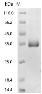 Human Insulin-like growth factor-binding protein 7 (IGFBP7) Recombinant Protein, N-10His, Homo sapiens (Human), Mammalian cell, N-terminal 10xHis-tagged, 29.2 kDa, purity >≥ 95% as determined by SDS-PAGE.