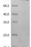 Human Nucleolar RNA helicase 2 (DDX21) Recombinant Protein - BioCrest Sci