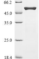Escherichia coli O157:H7 Dihydrolipoyllysine-residue succinyltransferase component of 2-oxoglutarate dehydrogenase complex (sucB) Recombinant Protein - BioCrest Sci