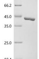 Macaca fascicularis Uricase (UOX) Recombinant Protein - BioCrest Sci