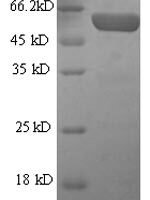 Mouse Glial fibrillary acidic protein (Gfap) Recombinant Protein, N-His-SUMO - BioCrest Sci
