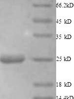 Human Histone deacetylase 7 (HDAC7), partial Recombinant Protein - BioCrest Sci