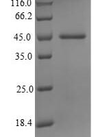 Human Probable JmjC domain-containing histone demethylation protein 2C (JMJD1C), partial Recombinant Protein - BioCrest Sci