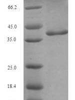 Blattella germanica Glutathione S-transferase Recombinant Protein, N-His-SUMO - BioCrest Sci
