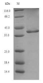 Blattella germanica Glutathione S-transferase Recombinant Protein, N-His-SUMO, Blattella germanica (German cockroach) (Blatta germanica), E.coli, N-terminal 6xHis-SUMO-tagged, 39.2 kDa, purity >≥ 90% as determined by SDS-PAGE.