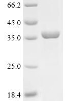 Leptospira interrogans serogroup Icterohaemorrhagiae serovar Lai Flagellar filament 35 kDa core protein (flaB) Recombinant Protein - BioCrest Sci