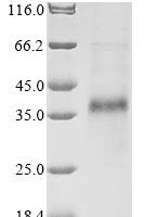 Bovine Cathelicidin-1 (CATHL1) Recombinant Protein - BioCrest Sci