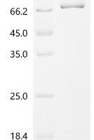 Mouse Cyclic GMP-AMP synthase (Cgas) Recombinant Protein - BioCrest Sci
