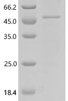 Tetraodon nigroviridis N-acetyltaurine hydrolase (pter) Recombinant Protein - BioCrest Sci