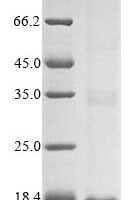 Yersinia kristensenii Heat-stable enterotoxin (yst) Recombinant Protein - BioCrest Sci