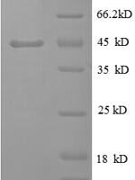 Bovie Tumor necrosis factor (TNF), partial Recombinant Protein, N-GST - BioCrest Sci
