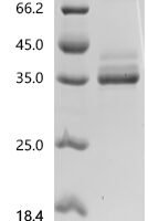 Human Tumor necrosis factor receptor superfamily member 12A (TNFRSF12A), partial Recombinant Protein - BioCrest Sci