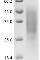 Human Ran-binding protein 3-like (RANBP3L) Recombinant Protein, C-His-Flag, aa 1–465, Yeast - BioCrest Sci