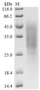 Human Ran-binding protein 3-like (RANBP3L) Recombinant Protein, C-His-Flag, aa 1–465, Yeast, Homo sapiens (Human), Yeast, C-terminal 6xHis-Flag-tagged, 54.7 kDa, purity >≥ 95% as determined by SDS-PAGE.