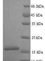 Human Group XIIA secretory phospholipase A2 (PLA2G12A), partial Recombinant Protein - BioCrest Sci
