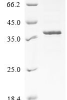 Mouse Melanoma-associated antigen H1 (Mageh1) Recombinant Protein - BioCrest Sci