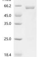 Human Aldehyde dehydrogenase, mitochondrial (ALDH2) Recombinant Protein - BioCrest Sci