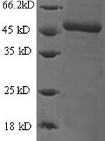 Human DCN1-like protein 1 (DCUN1D1) Recombinant Protein - BioCrest Sci