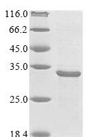 Mycobacterium tuberculosis Heparin-binding hemagglutinin (hbhA) Recombinant Protein - BioCrest Sci