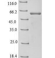 Bovine Aspartate aminotransferase, mitochondrial (GOT2) Recombinant Protein - BioCrest Sci