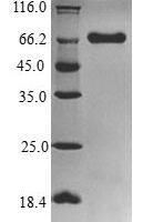 Porphyromonas gingivalis Gingipain R1 (rgpA), partial Recombinant Protein, N-His-B2M - BioCrest Sci