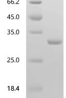 Human HLA class II histocompatibility antigen, DM beta chain (HLA-DMB),partial Recombinant Protein - BioCrest Sci
