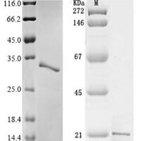 Hepatitis delta virus genotype I Small delta antigen Recombinant Protein, N-10His/C-Myc - BioCrest Sci