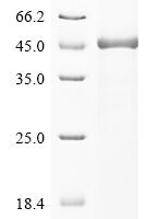 Human E3 ubiquitin-protein ligase SMURF1 (SMURF1), partial Recombinant Protein - BioCrest Sci