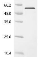 Human C-type lectin domain family 9 member A (CLEC9A), partial Recombinant Protein - BioCrest Sci