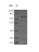 Human Serine racemase (SRR) Recombinant Protein, N-His-SUMO - BioCrest Sci