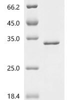 Human Interleukin-20 receptor subunit alpha (IL20RA), partial Recombinant Protein, C-His - BioCrest Sci